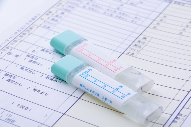 便潜血検査とは